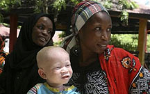 albinos in tanzania