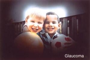 glaucoma view